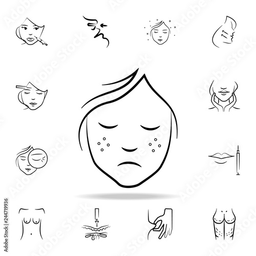 freckles on the face icon. Detailed set of anti-aging procedure icons. Premium graphic design. One of the collection icons for websites, web design, mobile app