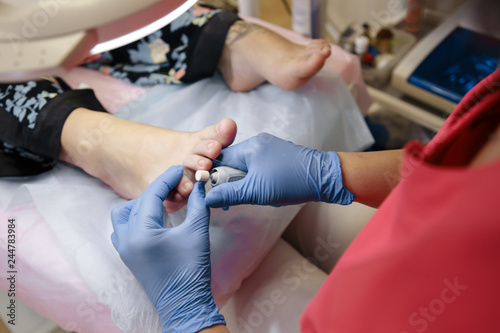 Podiatrist treating toenail fungus. Podology treatment. - Image