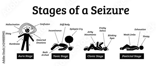 Stages and phases of a seizure. Illustrations depicts the phases when a person get a seizure which are the aura, tonic, clonic, and postictal stages. photo