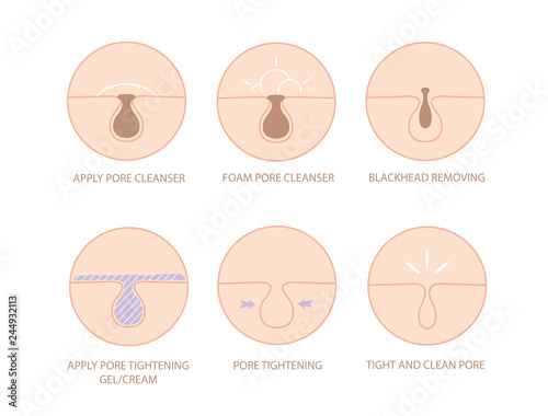 Blackheads removing and pore cleansing symbol set.