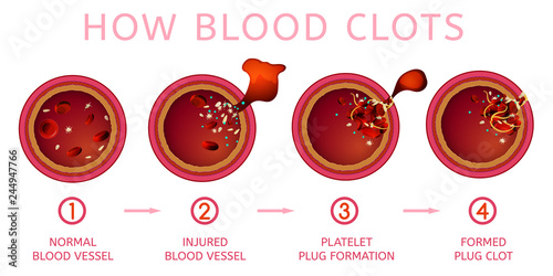 Blood clotting process