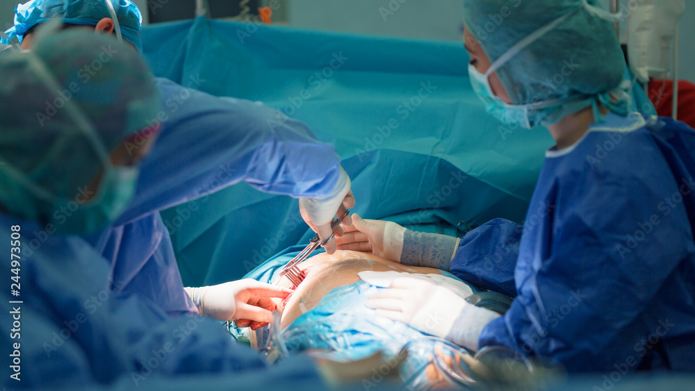 open heart cardiac surgery in hospital cardiovascular microsurgery with minithoracotomy procedure, surgeon operating beating heart surgery with his medical team open heart cardiac surgery in hospital cardiovascular microsurgery with minithoracotomy procedure, surgeon operating beating heart surgery with his medical team