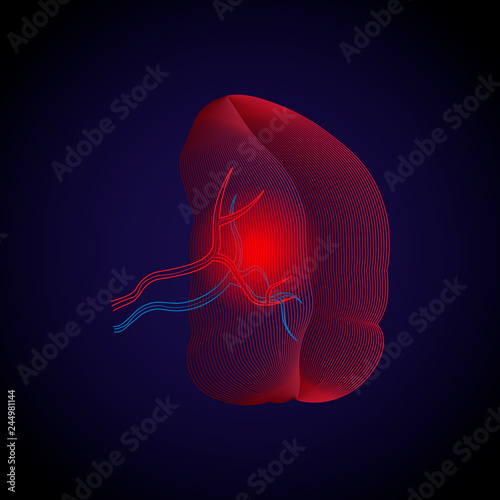 Medical illustration of the lines.. X-ray effect of spleen disease point of pain, abscess, cysts, rupture, Echinococcosis and Amyloidosis