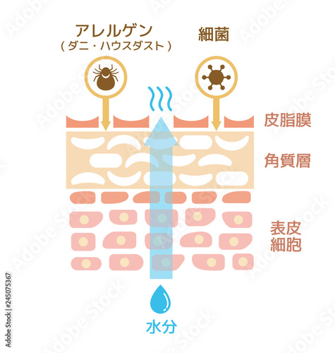 皮膚断面図 / ダメージを受けた皮膚イラスト (文字あり)