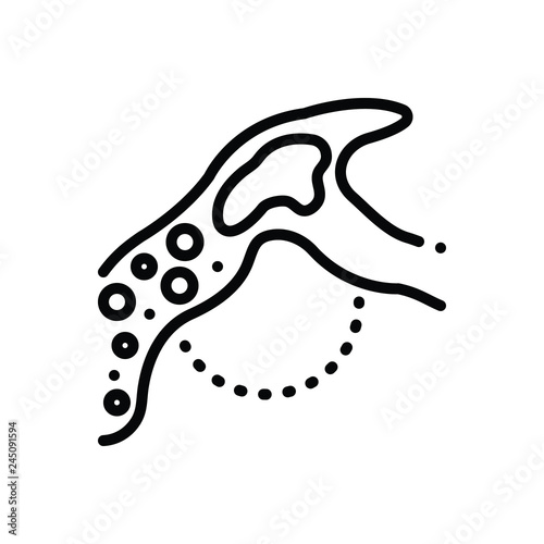 Black line icon for embolism 