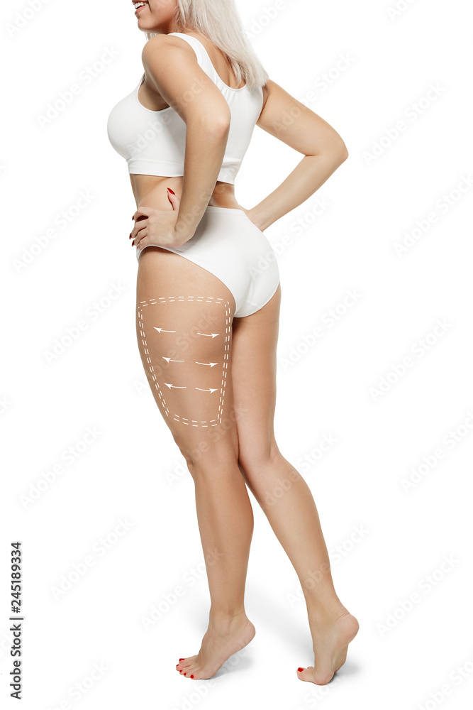 Female body with the drawing arrows. Fat lose, liposuction and cellulite removal concept. Marks on the woman before plastic surgery. The concept of plastic surgery