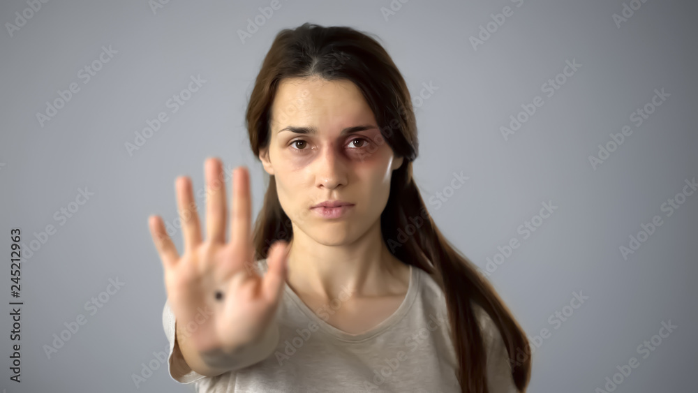 Bruised woman with black dot on hand, secret community for female victims Bruised woman with black dot on hand, secret community for female victims