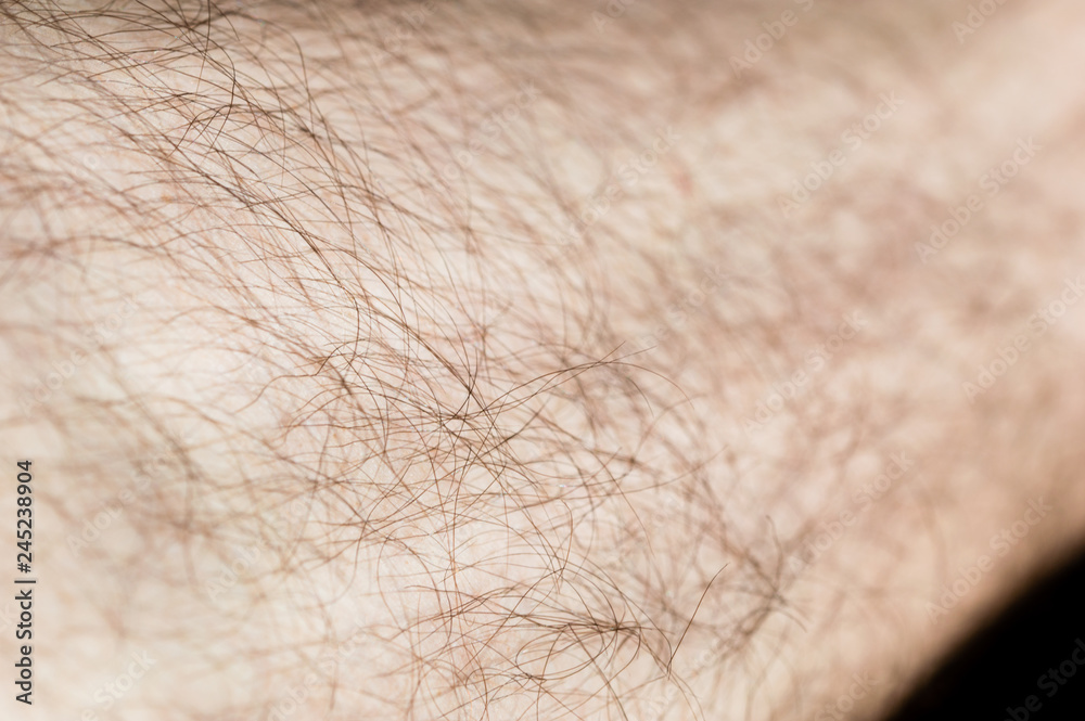 Hair on the human leg. Hair on the human leg.