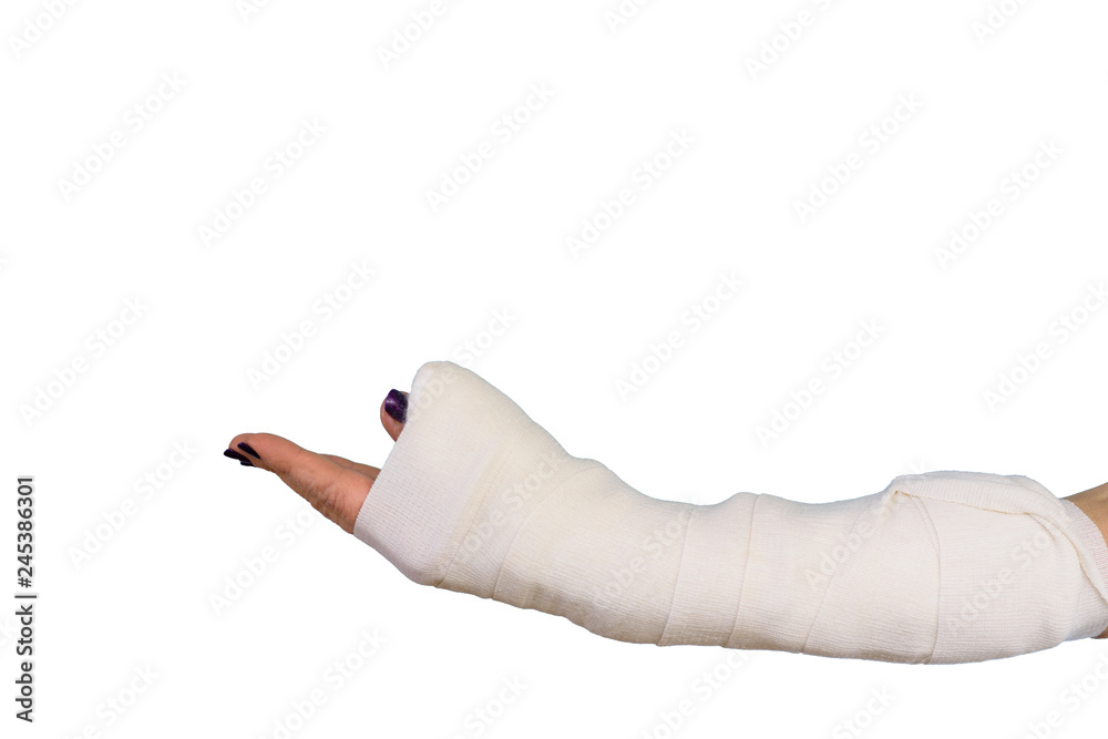 Hand In Cast Stock Photo - Download Image Now - Orthopedic Cast, Bone  Fracture, Broken Arm - iStock