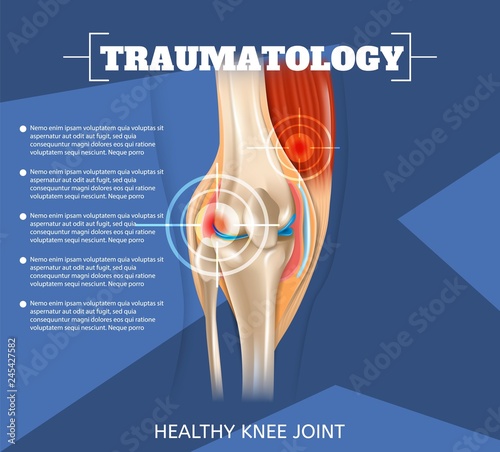 Realistic Illustration Traumatology Medicine in 3d