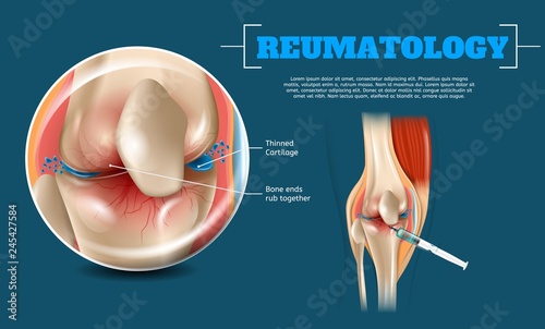 Realistic Image Benefits Correct Injection Site