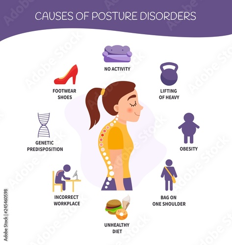 Infographics of posture disorders. Causes of the disease. Illustration of cute girl.