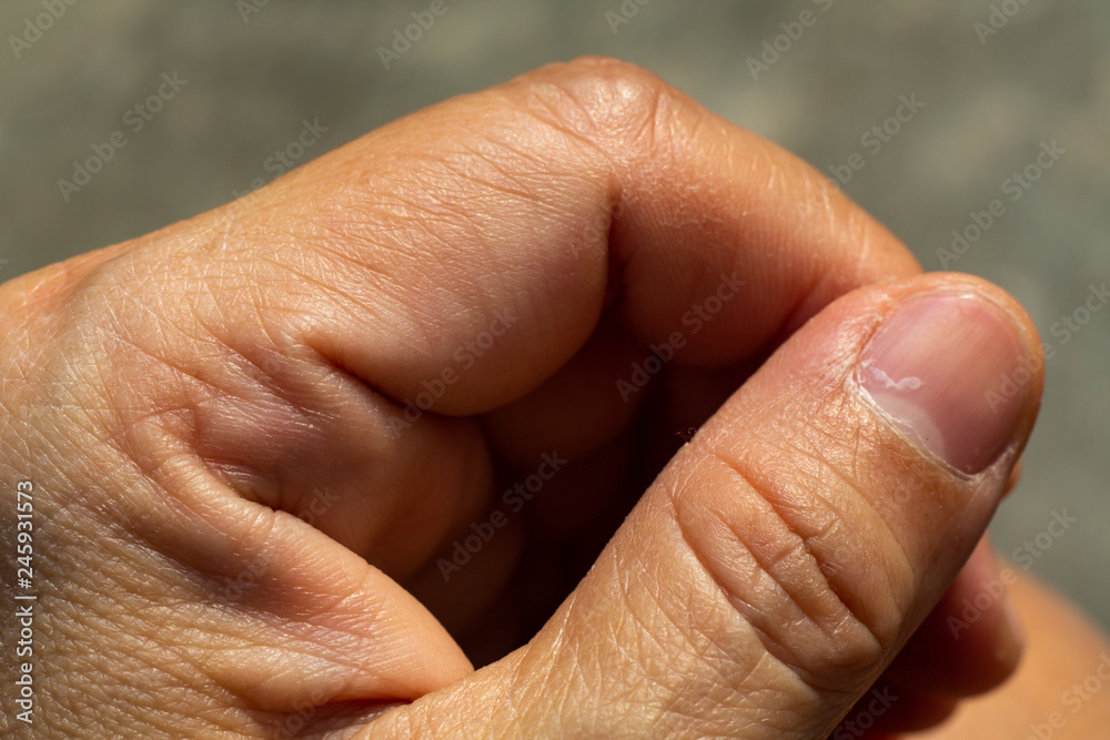 Woman's knuckle of thump finger, Close up & Macro shot, Asian Body skin part, Healthcare concept, Abstract background Woman's knuckle of thump finger, Close up & Macro shot, Asian Body skin part, Healthcare concept, Abstract background
