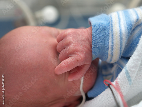 Premature baby hand