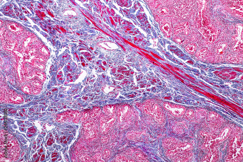 Concept of Education anatomy and physiology of mammary gland is an exocrine gland in mammals under the microscopic in laboratory.