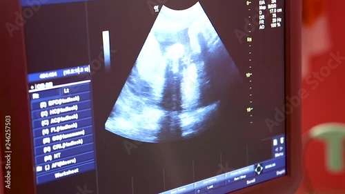 A Doctor is pointing the baby out to a family on the screen of an ultrasound machine. photo