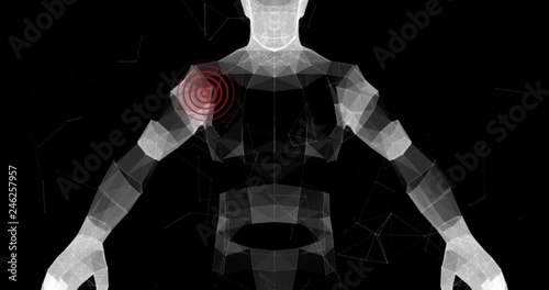 Shoulder Pain 3D Model of Male Upper Body 4k Video Footage Animation.