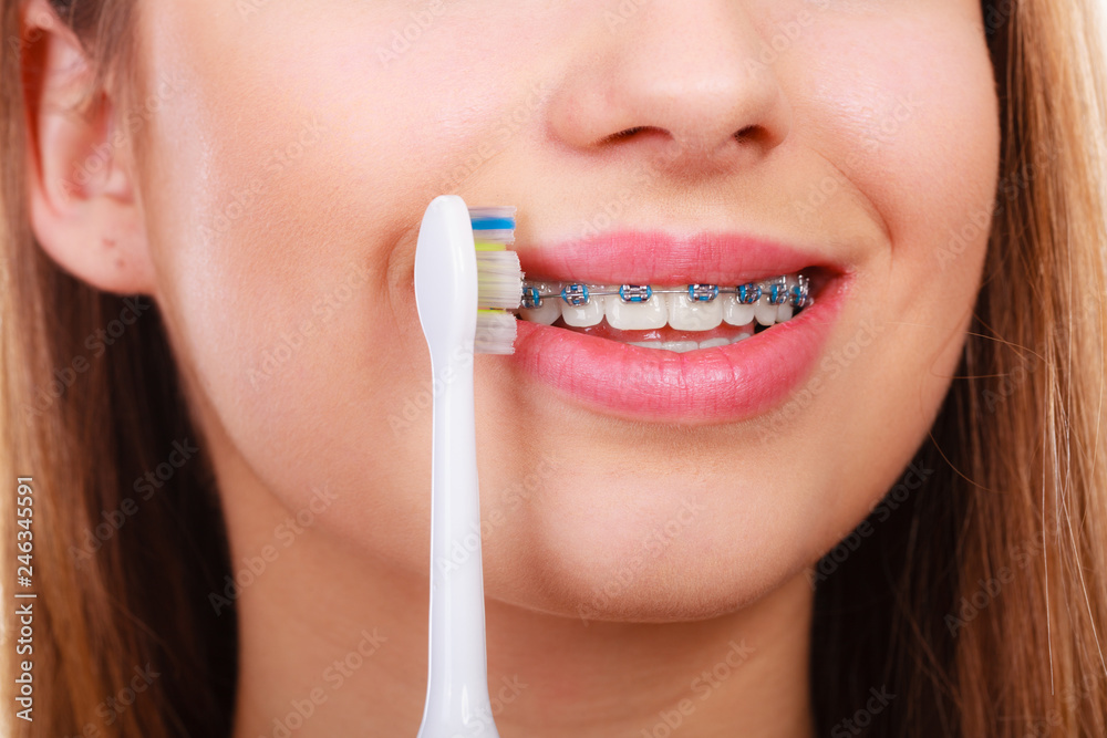 Fototapeta premium Woman brushing teeth with braces using brush