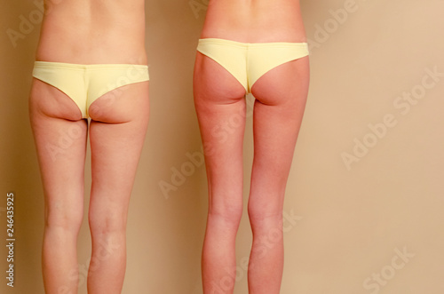 a cropped photo of two girls dressed in underwear. Women of different shapes, younger and older, slimmer and fuller