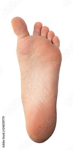 Varism on big toe of woman barefoot © Alessandro Grandini