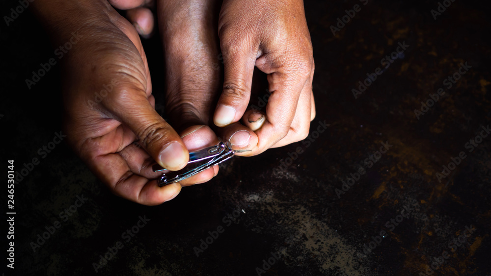 Focusing on the hands and feet, cutting black and dirty toenails. Focusing on the hands and feet, cutting black and dirty toenails.