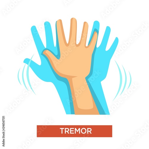 Hand tremor neurological disorder human body part
