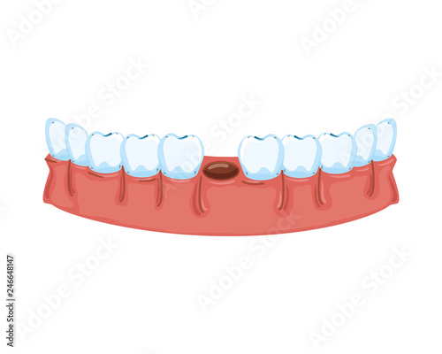 human teeth without one tooth