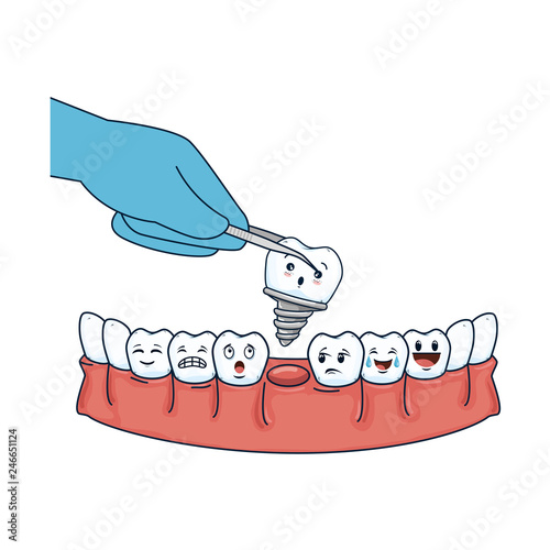 human teeth with pliers extracting implant