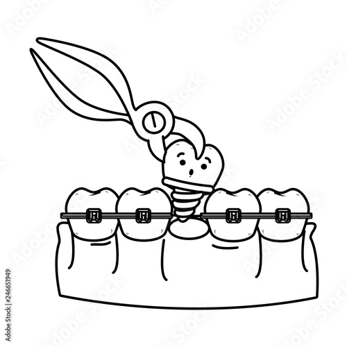 human teeth with pliers extracting implant