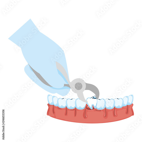 dentist extracting tooth with pliers