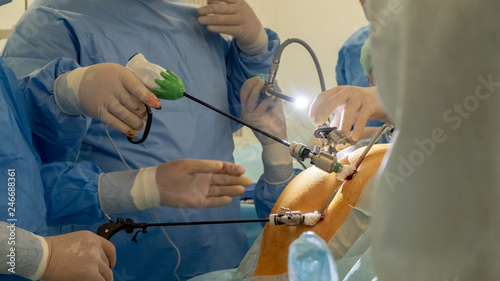 Endoscopy, laparoscopy, surgery. Operating room in a hospital. The team of surgeons performs an operation using medical endo-video equipment and instruments. Holes in the abdomen, local lighting.