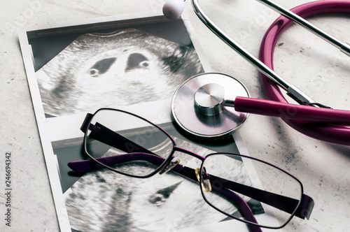 A phonendoscope or stethoscope and glasses lie on ultrasound images of an embryo of fraternal twins at 4 weeks gestation. IVF in vitro fertilization. Selective focus.