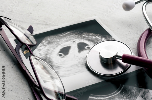 A phonendoscope or stethoscope and glasses lie on ultrasound images of an embryo of fraternal twins at 4 weeks gestation. IVF in vitro fertilization. Selective focus.