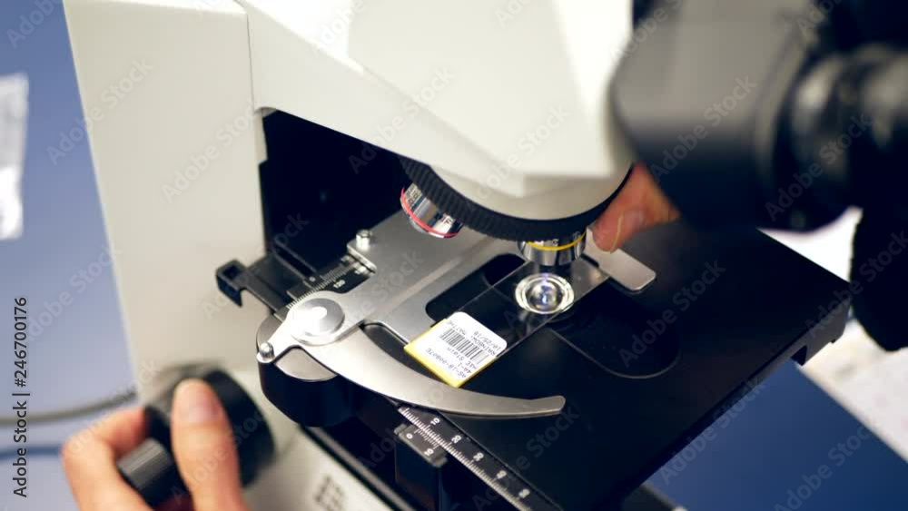 A scientist diagnosing a slide of cancer cells from a medical biopsy on a microscope in a hospital research science lab.
