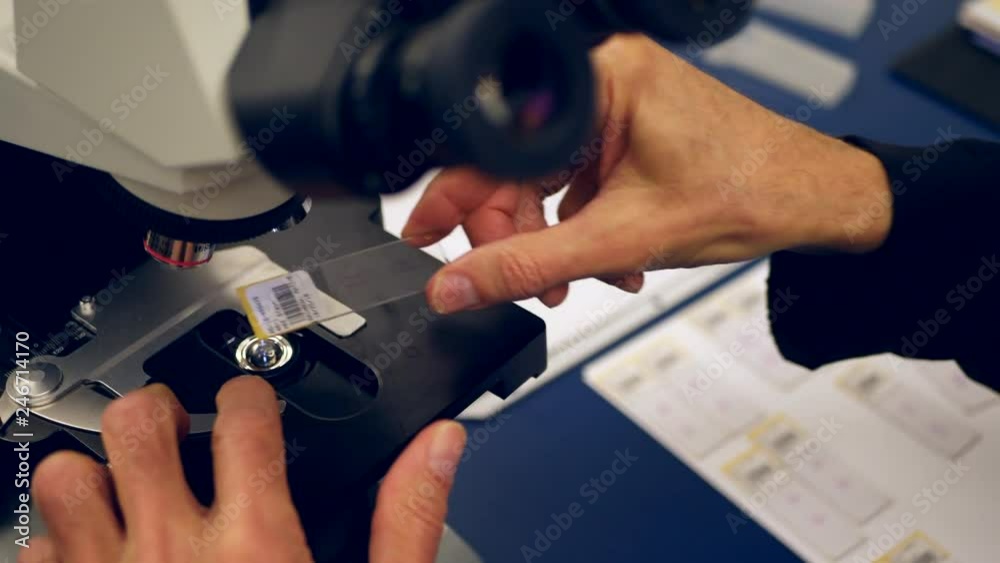 A scientist preparing a slide of his own cancer cells from a medical biopsy on a microscope in a medical research science lab.