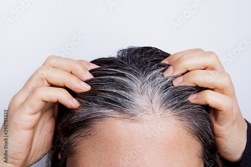 Young woman with white hair problem