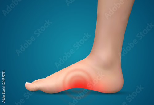 vector human foot.red spots of pain. ready element for medicine and orthopedics