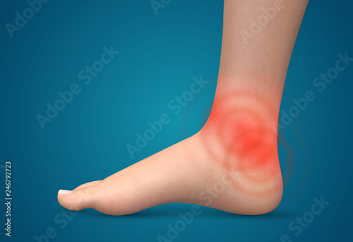 vector human foot.red spots of pain. ready element for medicine and orthopedics