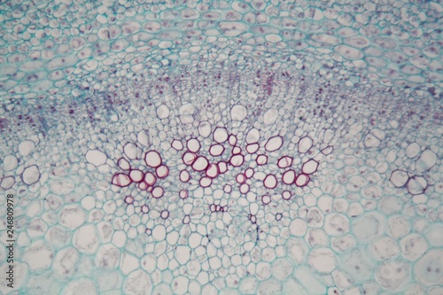 Sambucus stem with parenchyma cells under the microscope photo