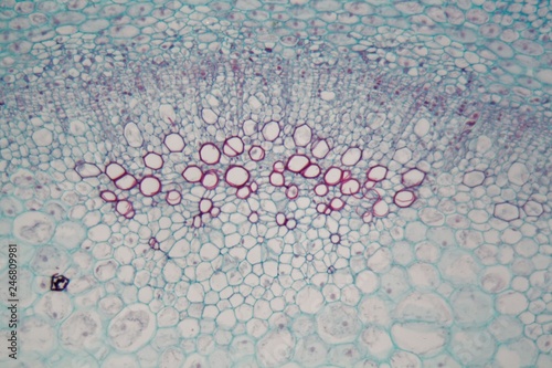 Fotografía Sambucus stem with parenchyma cells under the microscope