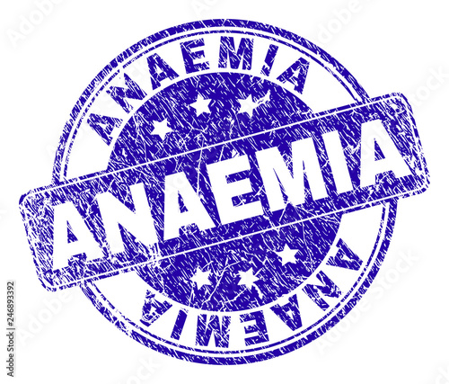 ANAEMIA stamp seal imprint with distress style. Designed with rounded rectangle and circles. Blue vector rubber print of ANAEMIA title with dust style.