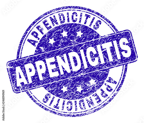APPENDICITIS stamp seal watermark with distress style. Designed with rounded rectangle and circles. Blue vector rubber watermark of APPENDICITIS text with corroded style.
