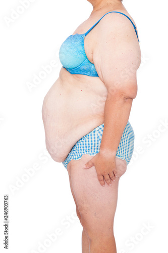 Middle aged woman with sagging skin after babies and extreme weight loss. Inspiration for poster and meme, before brachioplasty, panniculectomy, abdominoplasty and mummy makeover in Australia. photo