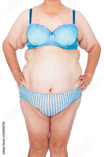 Middle aged woman with sagging skin after babies and extreme weight loss. Inspiration for poster and meme, before brachioplasty, panniculectomy, abdominoplasty and mummy makeover in Australia. photo