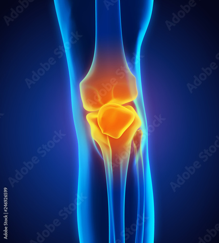 Painful Knee Illustration © nerthuz
