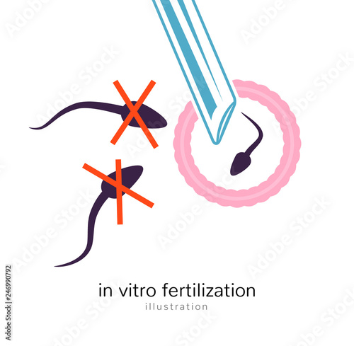 In vitro fertilisation icon. Biological insemination isolated medical infertility health vitro pregnancy