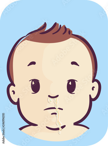 Baby Runny Nose Illustration