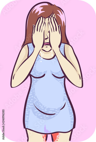 Girl Miscarriage Illustration