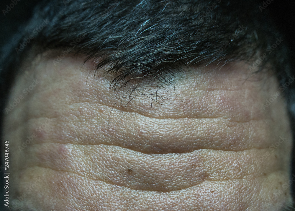 Naklejka premium Forehead with wrinkles