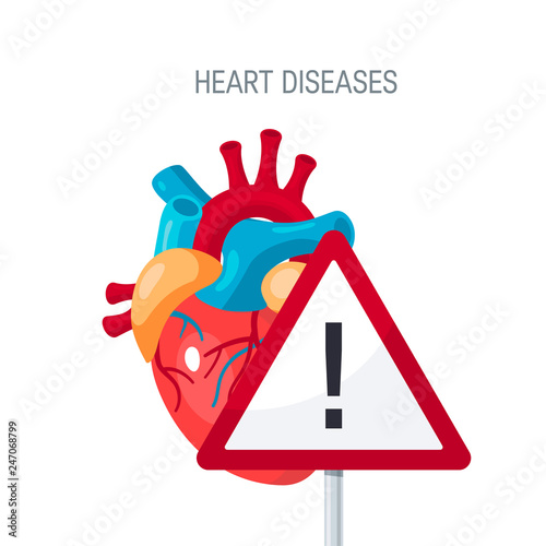 Heart diseases vector concept in flat style